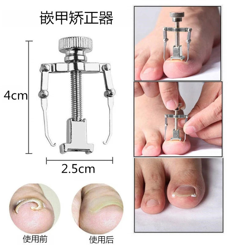 Set Corrector de Uñas Encarnadas