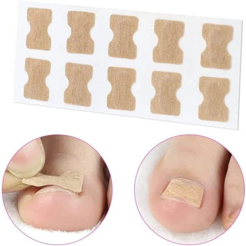 Set Corrector de Uñas Encarnadas